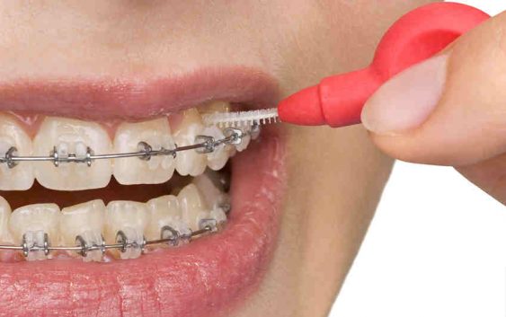 Ortodonta Toruń - leczenie wad zgryzu gabinet ortodontyczny